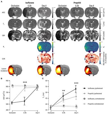 Propofol anesthesia improves stroke outcomes over isoflurane anesthesia—a longitudinal multiparametric MRI study in a rodent model of transient middle cerebral artery occlusion